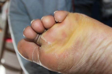 Faire peau neuve avec Baby Foot Faire peau neuve avec Baby Foot