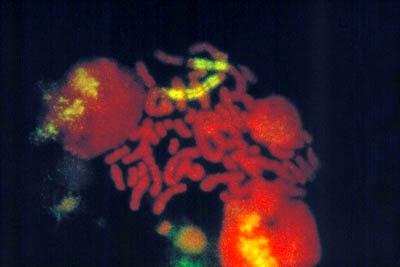 #tumorigenèse #autophagie #anoïkis Fonctions cellulaires et métaboliques liées à l’autophagie dans les cellules cancéreuses