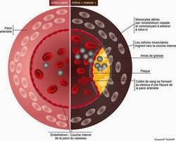 #hypercholestérolémie #evolocumab Inhibition de PCSK9 à l’aide de evolocumab (AMG 145) dans l’hypercholestérolémie familiale (RUTHERFORD-2) : étude randomisée, en double aveugle, contrôlée par placebo