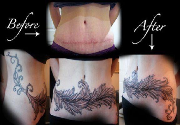 Des tatouages couvrant des cicatrices - Paperblog