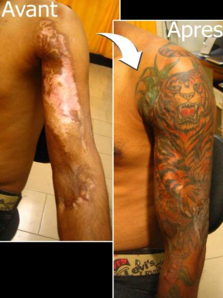 tattoo-camouflage-cicatrice-tatouage -scar-mogwaii (1)