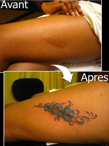 tattoo-camouflage-cicatrice-tatouage -scar-mogwaii (3)