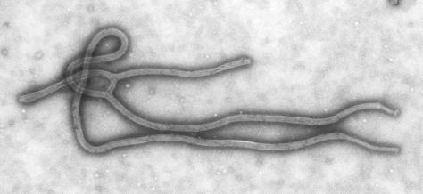 Photo au microscope d'un virus Ébola !