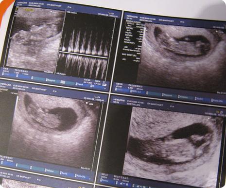 Moi j'aime pô les gamins....