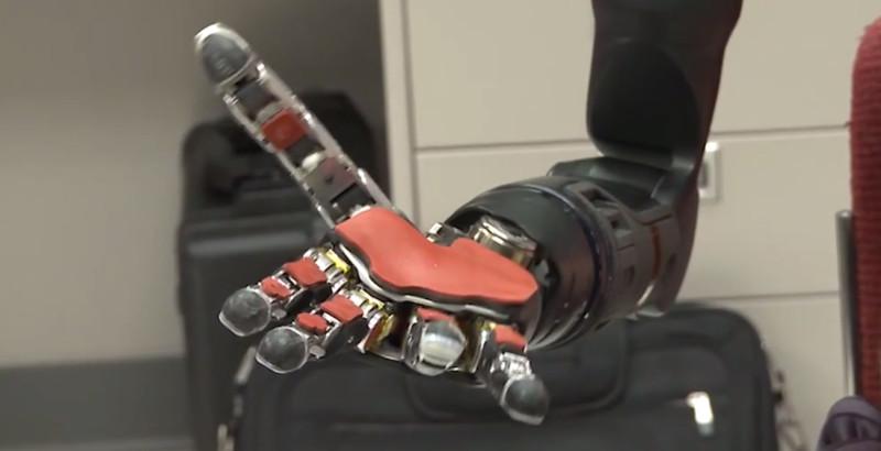 Un amputé s’inscrit dans l’Histoire en contrôlant deux prothèses robotisées