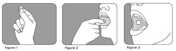 Les médicaments qui abîment les dents breakyl