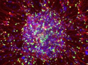 NEURO: Ils fabriquent de la démence in vitro  – Stem Cell Reports