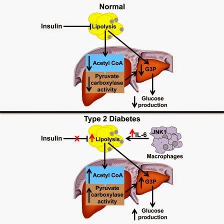 #Cell #AcétylCoA #foie #tissuadipeux #inflammation #diabètedetype2 #insulinorésistance Acétyl CoA hépatique : liens entre inflammation du tissu adipeux, insulino-résistance hépatique et diabète de type 2