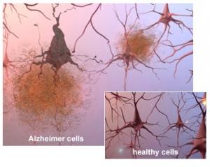 ALZHEIMER: Visite du Pr Hank F. Kung, père d’Amyvid® pour le diagnostic précoce de la maladie – CHRU Tours VISUEL-ALZH