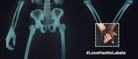 Des rayons X contre les préjugés LoveHasNoLabels