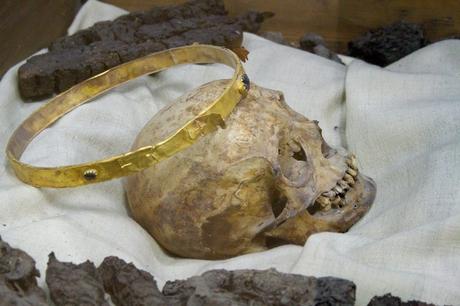 Actu insolite de mi-mars Squelette humain (origine inconnue).