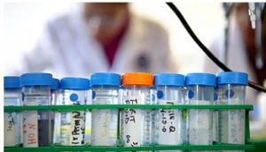 RHUMATISMES: Bientôt un test sanguin de détection précoce? – Scientific Reports
