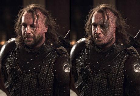 Tyrion Lannister aurait été bien plus défiguré après la bataille de Blakwater