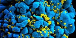 VIH: Un ouvre-boîte moléculaire pour décapsuler le virus  – PNAS
