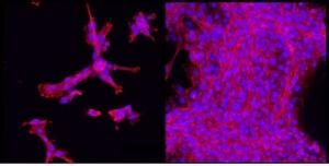 CICATRISATION, INGÉNIERIE TISSULAIRE: Un nouvel hydrogel multi-usages – Biomaterials CICATRISATION, INGÉNIERIE TISSULAIRE: Un nouvel hydrogel multi-usages – Biomaterials