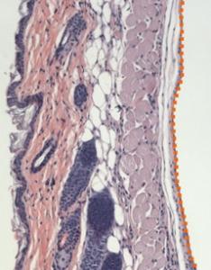 CICATRISATION, INGÉNIERIE TISSULAIRE: Un nouvel hydrogel multi-usages – Biomaterials CICATRISATION, INGÉNIERIE TISSULAIRE: Un nouvel hydrogel multi-usages – Biomaterials