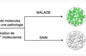 DIAGNOSTIC: Des bactosensors ou bactéries espions pour détecter les maladies – Inserm et Science Translational Medicine DIAGNOSTIC: Des bactosensors ou bactéries espions pour détecter les maladies – Inserm et Science Translational Medicine