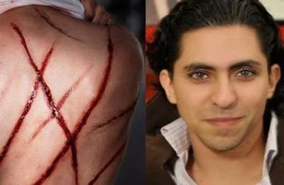 La Cour suprême confirme la sentence de Raif Badawi La Cour suprême confirme la sentence de Raif Badawi