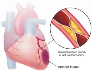 #trendsinendocrinologyandmetabolism #AMPK #ischémiecardiaque: capteur d’énergie et mécanisme de survie du cœur lors d’une ischémie