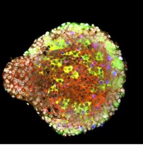 DIABÈTE de type 1: Le microbiote a un rôle protecteur à jouer  – Immunity