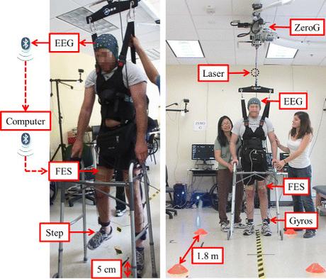 Avancée spectaculaire : un paraplégique remarche à nouveau s12984-015-0068-7-2