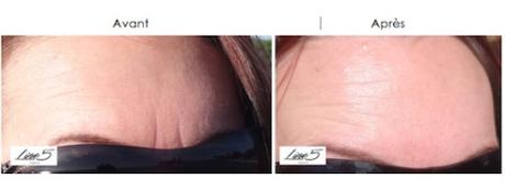 La lumière LED au service de la beauté La lumière LED au service de la beauté