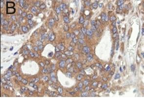 CANCER: Couper les vivres aux cellules tumorales via leurs capteurs alimentaires – Oncogene CANCER: Couper les vivres aux cellules tumorales via leurs capteurs alimentaires – Oncogene