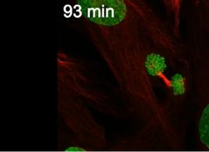DIVISION CELLULAIRE: La sentinelle qui veille aux erreurs chromosomiques – Journal of Cell Biology