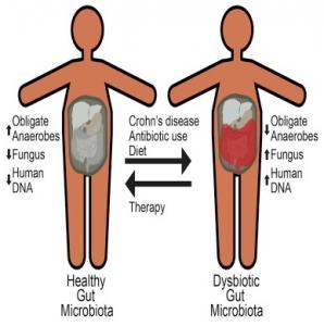 Maladie de CROHN: Traitements, réponse du microbiote et dysbiose intestinale  – Cell Host & Microbe