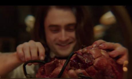 Victor Frankenstein (Ciné) a1