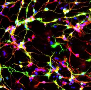 PARKINSON: Et si on pouvait changer les neurones défectueux? – Nature Communications