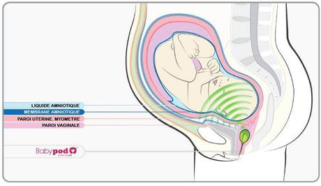 #Innovation : un tampon musical pour faire danser le futur nouveau-né ! #Innovation : un tampon musical pour faire danser le futur nouveau-né !