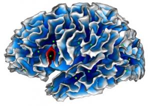 AUTISME: Un nouveau biomarqueur enfoui dans un pli du cortex – Biological Psychiatry