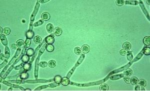 MICI: Le microbiote fongique, une nouvelle cible prometteuse – Gut