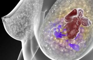 HORLOGE BIOLOGIQUE: Comment son décalage déclenche le cancer du sein  – ENDO 2016