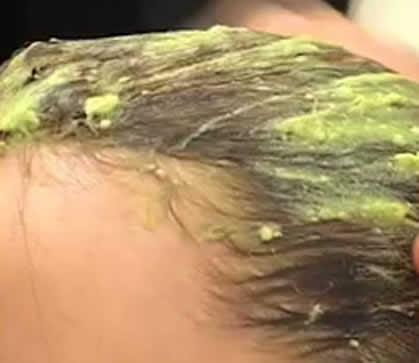 Avocat : ses bienfaits pour la santé, peau et cheveux avocat application