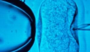 GROSSESSE: L'embryon se défend tout seul contre ses cellules défectueuses  – Nature Communications