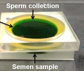 FIV: Les spermatozoîdes à l'épreuve de la microfluidique  – Biotechnology Advances