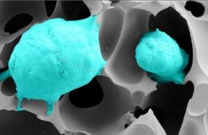 CANCER de la PROSTATE: Du cryogel en 3D pour suivre les cellules à la trace – Small