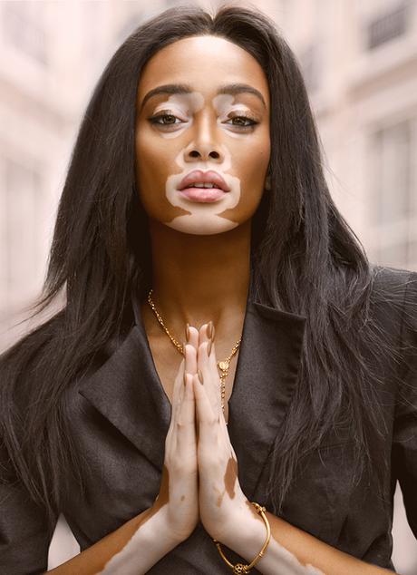 Winnie Harlow Winnie Harlow