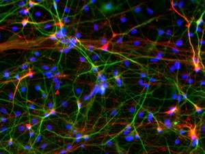AUTISME: Reprogrammer les neurones du patient  – Molecular Psychiatry