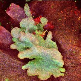 CANCER de la PEAU: Remonter à la toute toute première cellule tumorale – Nature