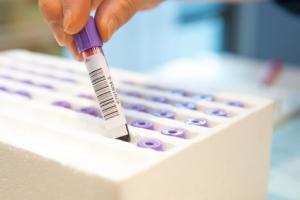 CANCER de l'OVAIRE: La biopsie liquide détecte la récidive avant la récidive – Scientific Reports