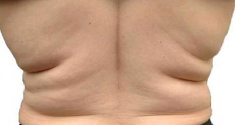 astuce pour maigrir du dos astuce pour maigrir du dos