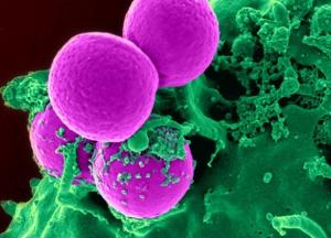 ANTIBIORÉSISTANCE: Notre nez lui, sait lutter contre les superbactéries   – Nature