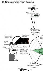 PARALYSIE: Un interface cerveau-machine permet à 8 paraplégiques de remarcher – Scientific Reports PARALYSIE: Un interface cerveau-machine permet à 8 paraplégiques de remarcher – Scientific Reports