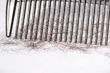 Que faire contre les cheveux cassants ? Que faire contre les cheveux cassants ?