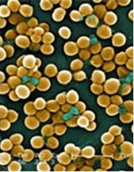 ANTIBIORÉSISTANCE: Les superbactéries planquent leurs métallo-ß-lactamases  – Nature Chemical Biology