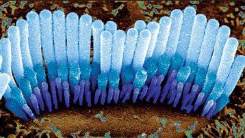 Cellules ciliées - Acouphènes solutions