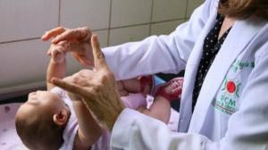 ZIKA: 2 candidats vaccins pour une immunité neurologique chez le nouveau-né – EBioMedicine